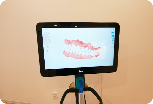 口腔内スキャナー（NiRi対応iTero）