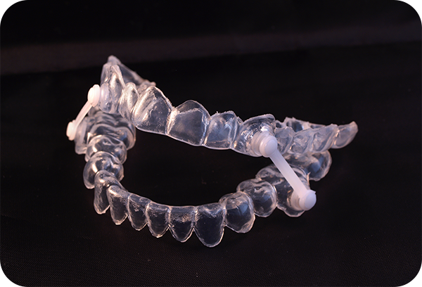 スリープスプリント（睡眠時無呼吸症候群治療）