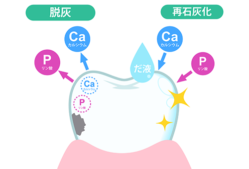 むし歯ができるのはなぜ？